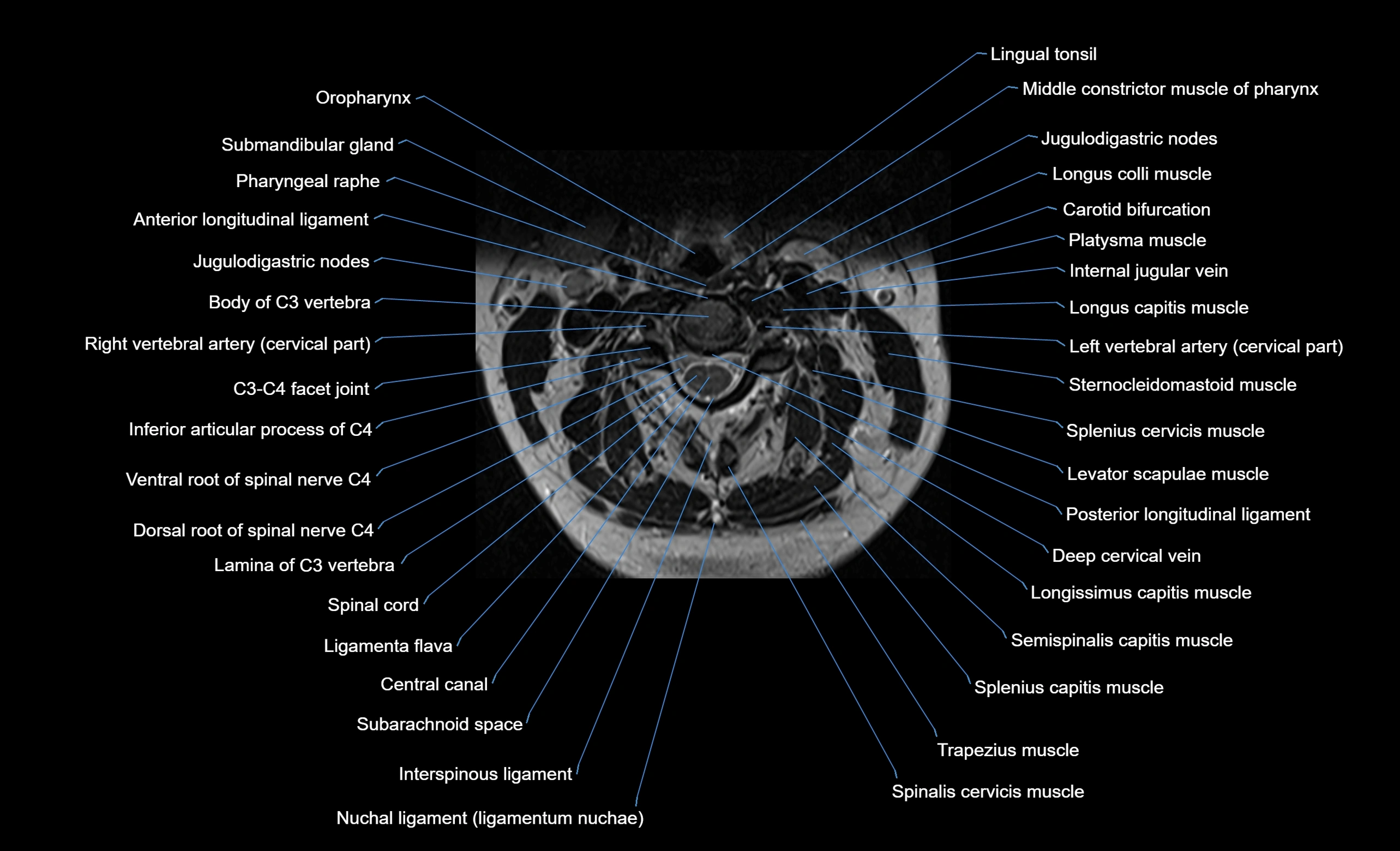 cervical spine cross sectional MRI anatomy  3T MRI axial  image-img-00001-00017.webp